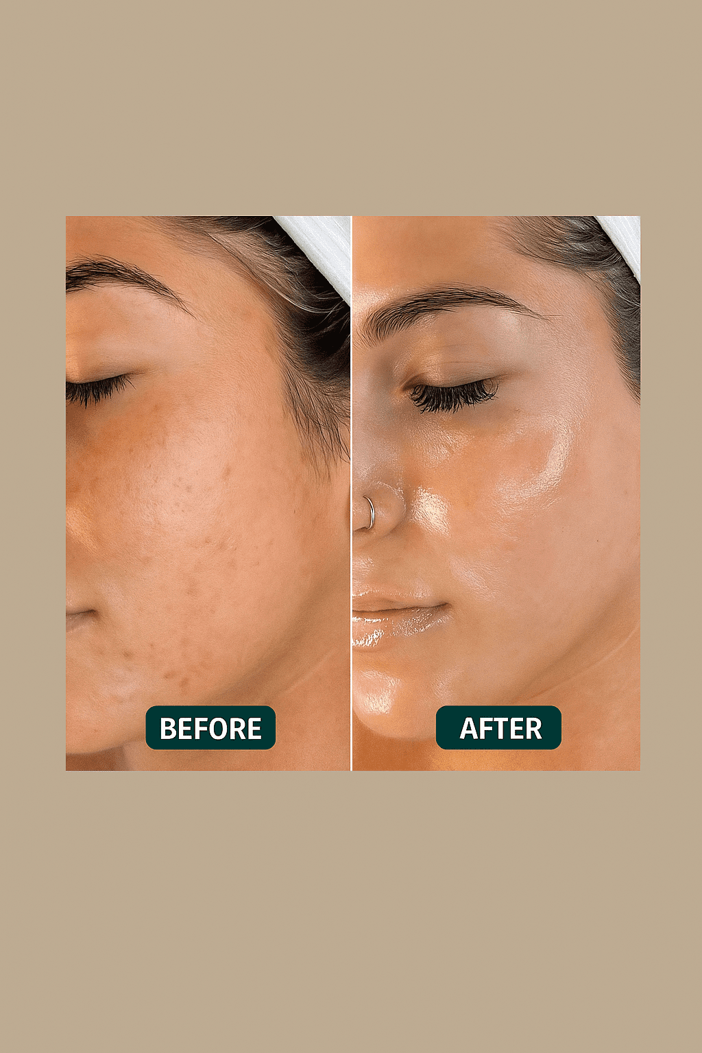 Before the Glow: Important Insights Only Skin Analysis